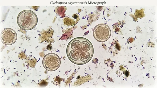 Cyclospora Parasite Outbreak