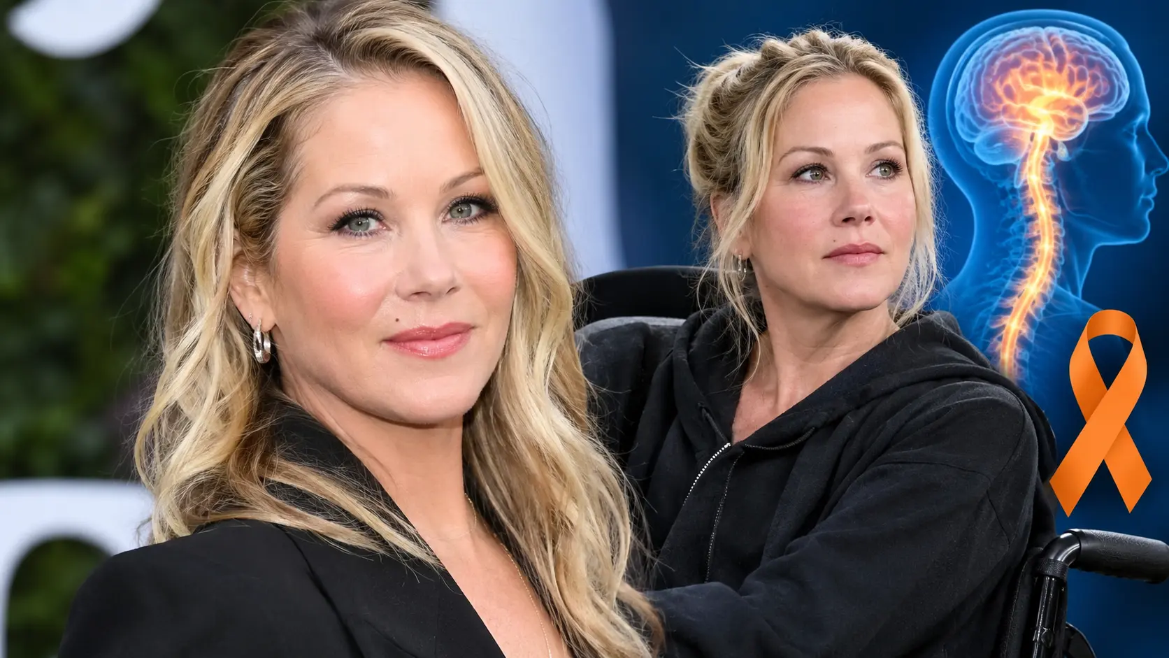 Christina Applegate's MS Journey awareness collage and recent health updates